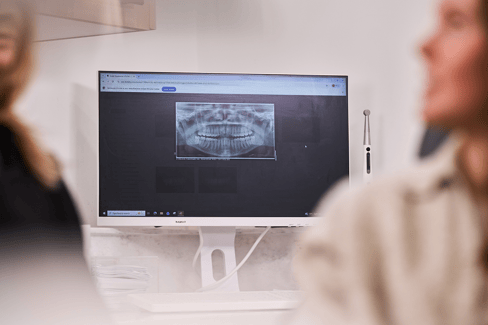 A photograph of a computer screen displaying an x-ray with two blurry people in the foreground