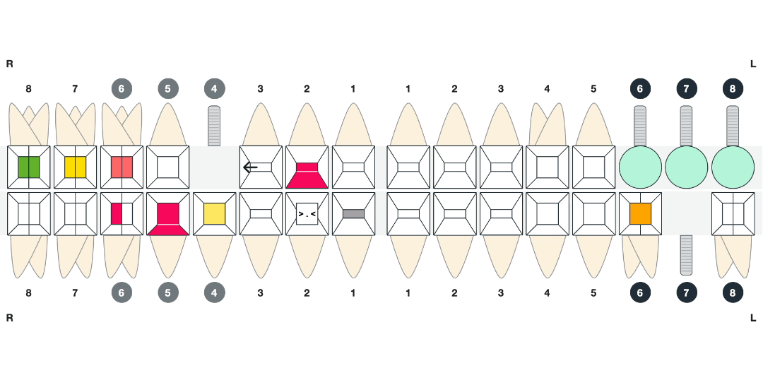 Mixed Teethmap A Smarter Way to Chart – New Mixed Dentition