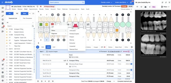 Screenshot of the chart in dentally with the clinical sidebar open on images and the user clicking the socket to open the selection menu